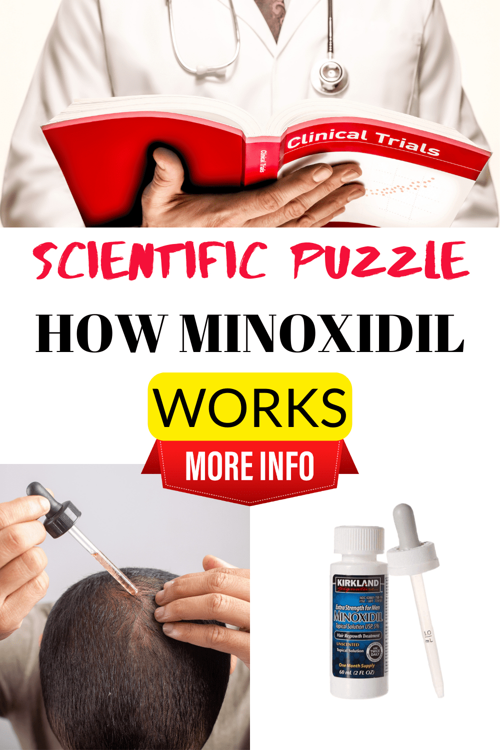 hair-products-how-minoxidil-works
